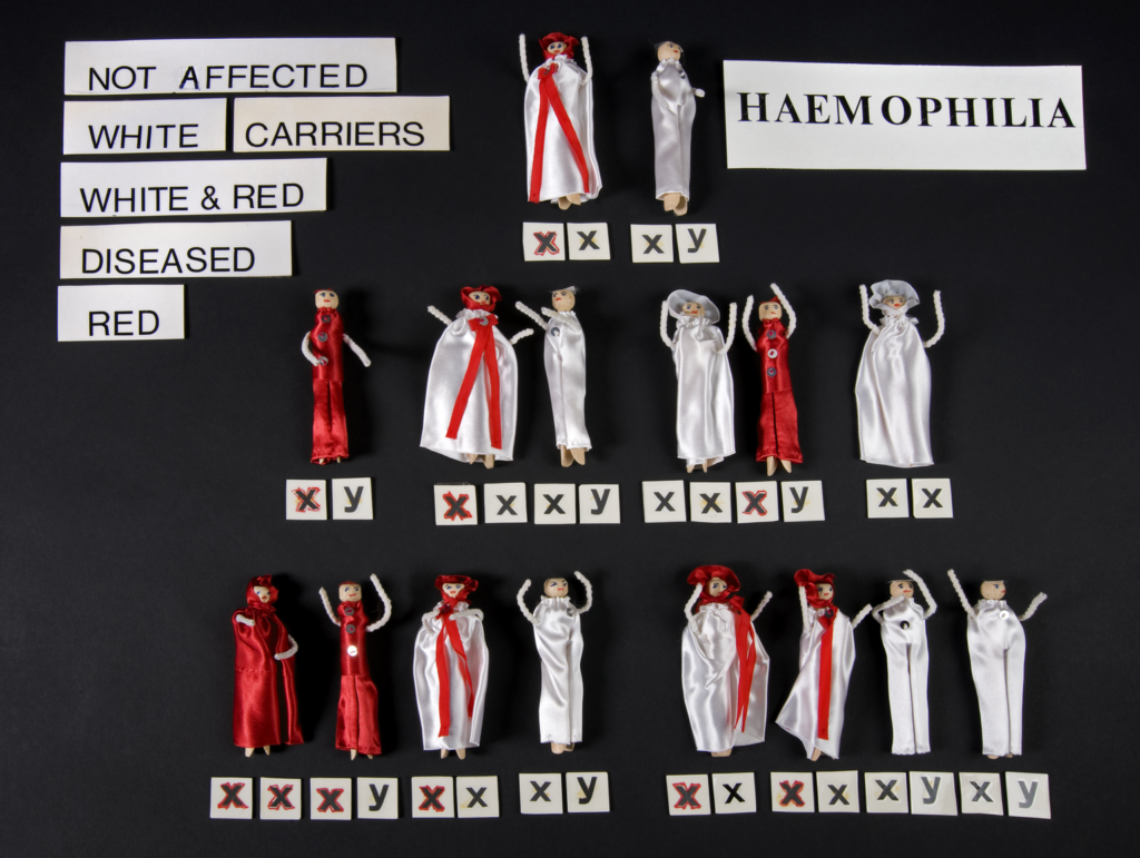 A set of dolls in red and white outfits on a black background. Underneath each doll are two letters: x or y. Some x's are outlined in read - this denotes haemophilia. There are two dolls in the top row. The doll on the left wear white with a red scarf, and has one red x and one x. Next to it a doll in white has x and y. The next row includes: a doll in red with red x and y; a doll in white with a red scarf and a red x and x; a doll in white with x and y; a doll in white with x and x; a doll in red with a red x and y; and a doll in white with x and x. The bottom row includes: a doll in red with two red x's; a doll in red with a red x and y; a doll in white with a red scarf and a red x and x; a doll in white with an x and y; two dolls in white with a red scarf, both with a red x and x; and finally two dolls in white, both with an x and y. In the top left, printed words say: "NOT AFFECTED - WHITE. CARRIERS - WHITE & RED. DISEASED - RED".