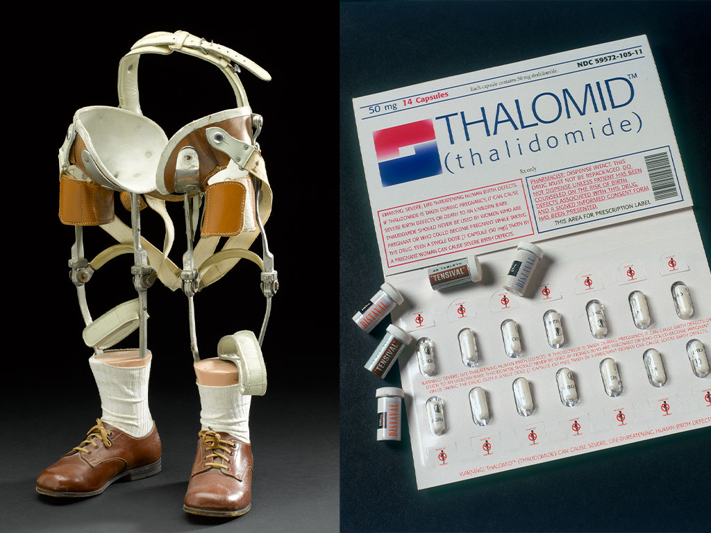 A composite of two images. On the left is a pair of prosthetic legs for a young child, Eddie Freeman. There is a kind of 'seat' for Eddie's hips to rest in, and various staps and buckles to keep them secure. The top of the legs are hollow and made of metal. There are hinges at the knees to allow Eddie fuller movement. At the bottom, the prosthetic feet have been given white socks and a pair of brown leather lace up shoes. On the right is an unopened blister packet of Thalomid(TM). It has two rows of tablets. Above each blister is an icon showing a pregnant person with a restricted sign - a red circle with a line going through it - over the top. This is repeated on the tablets themselves. There are many warnings in red text printed is different places on the packet, advising of "...severe, life threatening human birth defects".